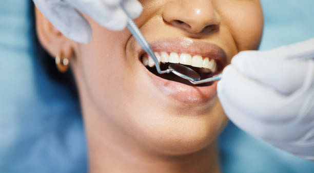 Best Emergency Dental Care for Broken or Chipped Teeth in Lake Dunlap, TX